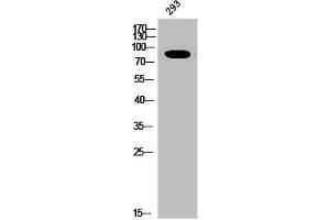 Western Blot analysis of 293 cells using Phospho-Insulin R (Y1361) Polyclonal Antibody (Insulin Receptor anticorps  (pTyr1361))