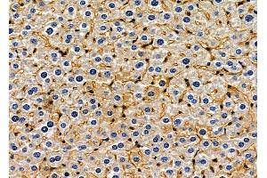 ABIN6265763 and ABIN6278539 at 1/100 staining mouse liver tissue by IHC-P.