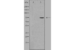 Western blot analysis of extracts from COLO205 cells, using HLX1 antibody. (HLX anticorps  (Internal Region))