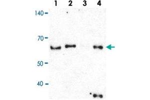 Immunoprecipitation of Lane 1: 5% Input, Lane 2: 5% Sup, Lane 3: Normal IgG and Lane 4: hn-RNPH1 ppt. (HNRNPH1 anticorps  (Internal Region))