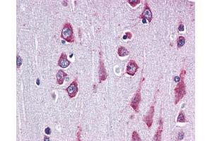 Immunohistochemistry (IHC) image for anti-Receptor-Associated Protein of The Synapse (RAPSN) (C-Term) antibody (ABIN2470685)