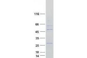 Validation with Western Blot