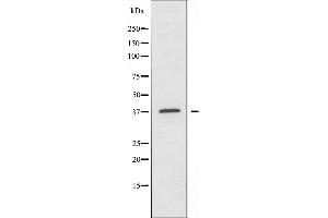 Western blot analysis of extracts from HeLa cells using TUSC3 antibody. (TUSC3 anticorps  (Internal Region))