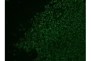 Formalin-fixed, paraffin-embedded human colol carcinoma stained with AF488-conjugated Nucleolin MAb (364-5 + NCL/902). (Nucleolin anticorps)