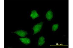 Immunofluorescence of purified MaxPab antibody to CMPK on HeLa cell.