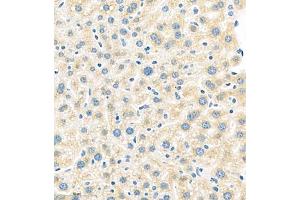 Immunohistochemistry of paraffin embedded mouse liver using MUC20 (ABIN7074692) at dilution of 1:1000 (400x lens) (MUC20 anticorps)
