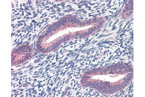 Immunohistochemistry (IHC) image for anti-Twist Homolog 1 (Drosophila) (TWIST1) (C-Term) antibody (ABIN2780347)