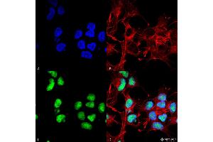 Immunocytochemistry/Immunofluorescence analysis using Rabbit Anti-Choline Acetyltransferase Polyclonal Antibody .