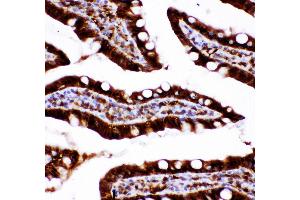 Anti-Caspase3 antibody, IHC(P) IHC(P): Rat Intestine Tissue (Caspase 3 anticorps  (AA 67-175))