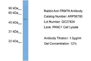 WB Suggested Anti-TRMT6  Antibody Titration: 0. (TRMT6 anticorps  (Middle Region))