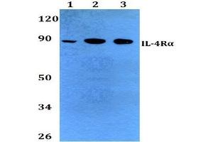 Western Blot (WB) analysis of CD124 / IL4R antibody at 1/500 dilution.