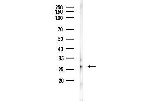 anti-Superoxide Dismutase 3, Extracellular (SOD3) (Internal Region) antibody