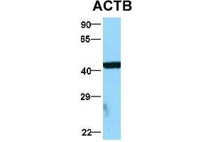 Host:  Rabbit  Target Name:  ACTB  Sample Type:  MCF7  Antibody Dilution:  1.