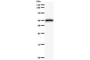 Western Blotting (WB) image for anti-Lysine (K)-Specific Demethylase 4A (KDM4A) antibody (ABIN932195)
