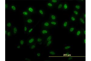 Immunofluorescence of monoclonal antibody to SIX4 on HeLa cell. (SIX4 anticorps  (AA 672-780))