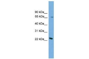 WB Suggested Anti-Foxn2 Antibody Titration:  0. (FOXN2 anticorps  (N-Term))