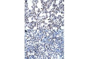 Immunohistochemical staining (Formalin-fixed paraffin-embedded sections) of human lung (A) and human spleen (B) with GCM1 polyclonal antibody  at 4-8 ug/mL working concentration. (GCM1 anticorps  (N-Term))