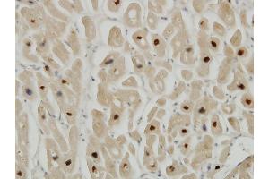 Immunoperoxidase of monoclonal antibody to TTN on formalin-fixed paraffin-embedded human heart. (Titin anticorps  (AA 1-110))