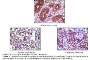Image no. 1 for anti-B Lymphoid Tyrosine Kinase (BLK) antibody (ABIN232110) (BLK anticorps)