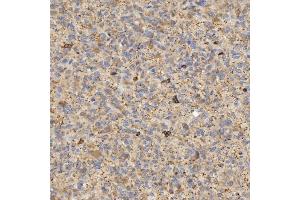 IHC analysis of EIF2AK1 using anti-EIF2AK1 antibody (ABIN7601508). (EIF2AK1 anticorps  (AA 37-508))