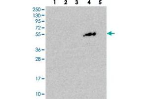 Western blot analysis of Lane 1: RT-4, Lane 2: U-251 MG, Lane 3: Human Plasma, Lane 4: Liver, Lane 5: Tonsil with PGBD4 polyclonal antibody .