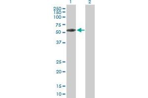 Western Blot analysis of KBTBD9 expression in transfected 293T cell line by KBTBD9 MaxPab polyclonal antibody. (KLHL29 anticorps  (AA 1-503))