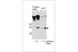 Western blot analysis of extracts from Jurkat cells,untreated or treated with paclitaxel,using phospho-Bcl2(Ser70)(left) or Bcl2 Antibody (right). (Bcl-2 anticorps  (pSer70))