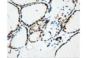 Image no. 3 for anti-Sorbitol Dehydrogenase (SORD) antibody (ABIN1501076) (SORD anticorps)