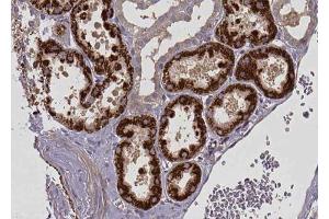 ABIN6272848 at 1/100 staining human kidney tissue sections by IHC-P.