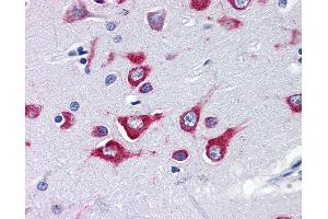 Anti-KIF5A antibody IHC of human brain, cortex. (KIF5A anticorps  (Internal Region))