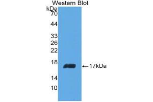 Western blot analysis of the recombinant protein. (IL-5 anticorps  (AA 20-134))