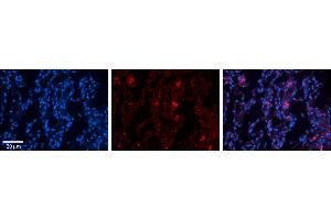 Rabbit Anti-FBXO21 Antibody     Formalin Fixed Paraffin Embedded Tissue: Human Lung Tissue  Observed Staining: Membrane and cytoplasmic in alveolar type I cells  Primary Antibody Concentration: 1:100  Other Working Concentrations: 1/600  Secondary Antibody: Donkey anti-Rabbit-Cy3  Secondary Antibody Concentration: 1:200  Magnification: 20X  Exposure Time: 0.