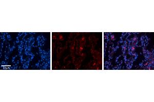 Rabbit Anti-FBXO21 Antibody     Formalin Fixed Paraffin Embedded Tissue: Human Lung Tissue  Observed Staining: Membrane and cytoplasmic in alveolar type I cells  Primary Antibody Concentration: 1:100  Other Working Concentrations: 1/600  Secondary Antibody: Donkey anti-Rabbit-Cy3  Secondary Antibody Concentration: 1:200  Magnification: 20X  Exposure Time: 0. (FBXO21 anticorps  (N-Term))