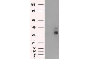 HEK293T cells were transfected with the pCMV6-ENTRY control (Left lane) or pCMV6-ENTRY BSG (Right lane) cDNA for 48 hrs and lysed. (CD147 anticorps)