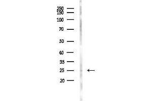 Western blot analysis of lysates from Mouse liver, using Phospho-p27 Kip1 (Ser10) Antibody at 1/1000 dilution.