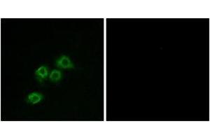 Immunofluorescence analysis of MCF7 cells, using GPR1 Antibody. (G Protein-Coupled Receptor 1 anticorps  (AA 121-170))