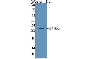 Western blot analysis of the recombinant protein. (ACADS anticorps  (AA 210-396))