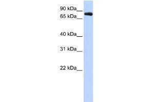 WB Suggested Anti-KCNC3 Antibody Titration:  0. (KCNC3 anticorps  (Middle Region))