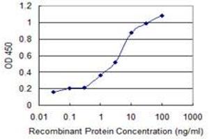 Detection limit for recombinant GST tagged RCBTB2 is 0.