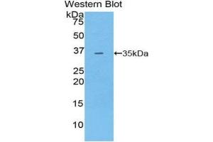 Western Blotting (WB) image for anti-Pyruvate Dehydrogenase Kinase, Isozyme 4 (PDK4) (AA 117-387) antibody (ABIN3207487) (PDK4 anticorps  (AA 117-387))