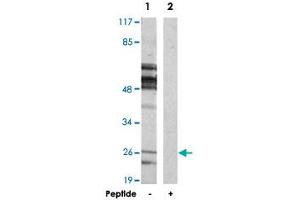 Western blot analysis of extracts from rat brain cells, using MOBKL3 polyclonal antibody . (MOBKL3 anticorps  (N-Term))