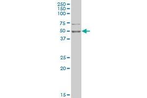 PHF1 monoclonal antibody (M02), clone 4D8 Western Blot analysis of PHF1 expression in K-562 . (PHF1 anticorps  (AA 2-100))