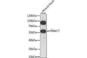 Western blot analysis of extracts of mouse heart, using TRIM17 antibody  at 1:1000 dilution. (TRIM17 / RNF16 anticorps  (AA 1-300))
