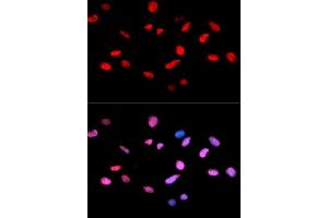 Immunofluorescence analysis of U2OS cells using Phospho-Rb-S811 antibody. (Retinoblastoma 1 anticorps  (pSer811))
