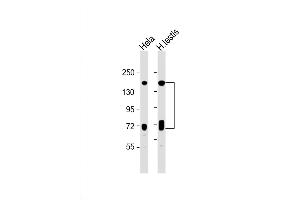 Western Blot at 1:1000 dilution Lane 1: Hela whole cell lysate Lane 2: human testis lysate Lysates/proteins at 20 ug per lane. (NASP anticorps  (N-Term))