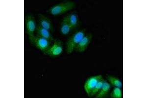 Immunofluorescent analysis of HepG2 cells using ABIN7144713 at dilution of 1:100 and Alexa Fluor 488-congugated AffiniPure Goat Anti-Rabbit IgG(H+L)