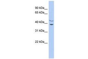Image no. 1 for anti-Harbinger Transposase Derived 1 (HARBI1) (AA 143-192) antibody (ABIN6743868) (HARBI1 anticorps  (AA 143-192))
