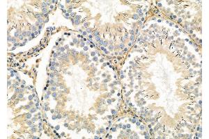 ABIN6263069 and ABIN6278932 at 1/100 staining Rat testis tissue by IHC-P. (MAGEC3 anticorps  (N-Term))