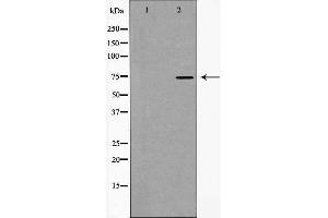 Western blot analysis of hnRNP M expression in HT29 cells,The lane on the left is treated with the antigen-specific peptide. (HNRNPM anticorps  (N-Term))