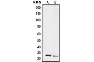 Western blot analysis of RPL10L expression in HL60 (A), HeLa (B) whole cell lysates. (RPL10L anticorps  (C-Term))